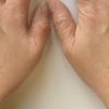 Yaluronica After Effect